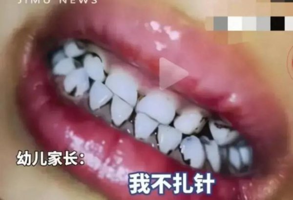 东启网 天水儿童铅中毒事件：我们还要付出多少“代价”才算够？